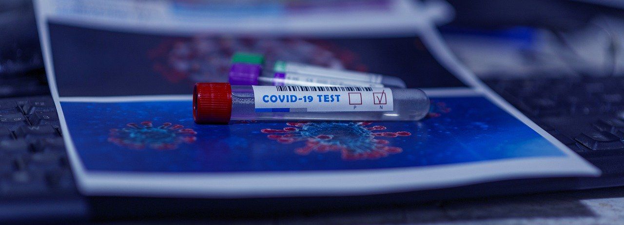 UAE Requires Negative Covid-19 test results