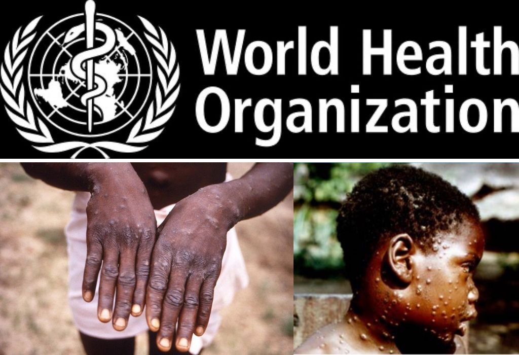Who Declares Monkeypox A Global Health Emergency 2 World Health Organization