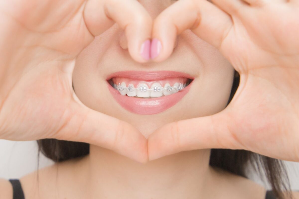 Holistic Orthodontist treats with ceramic braces